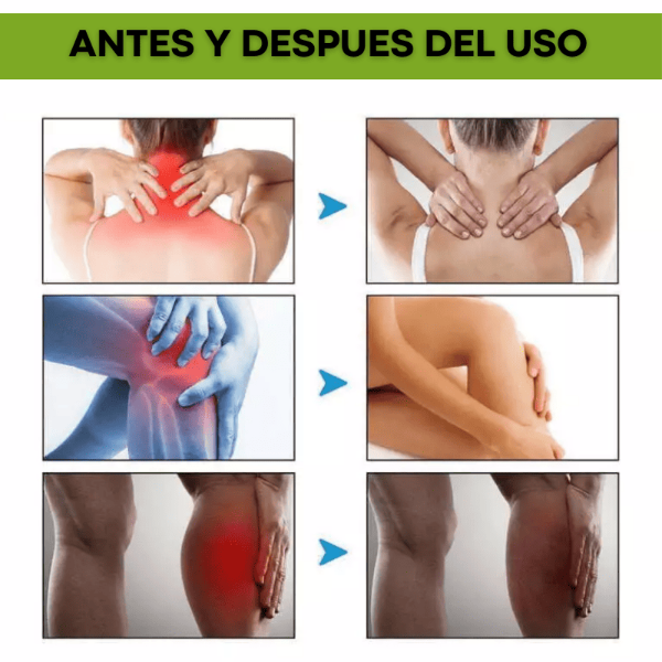 Beevana Crema para dolores a las articulaciones