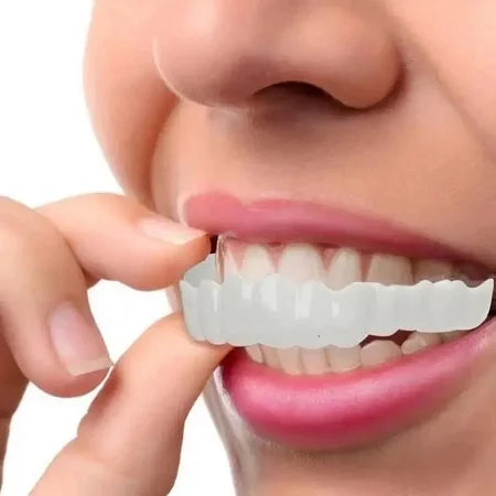 Carillas Plasticas Snapon Smile