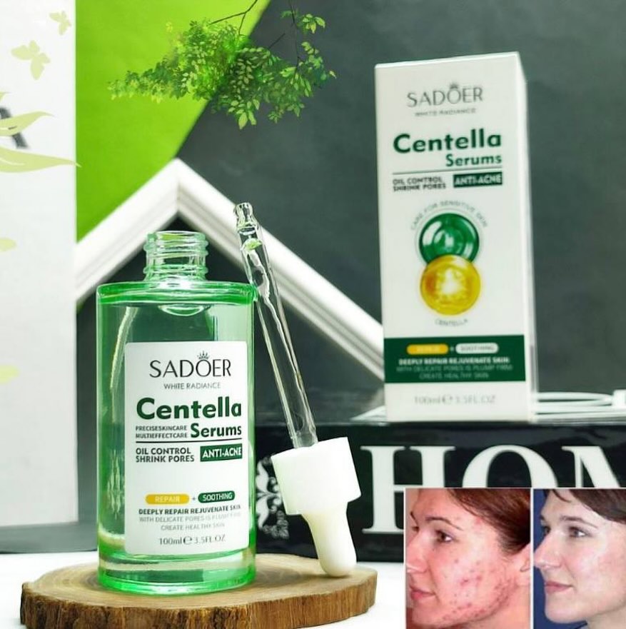 Serum Anti-Acne Radiance Centella