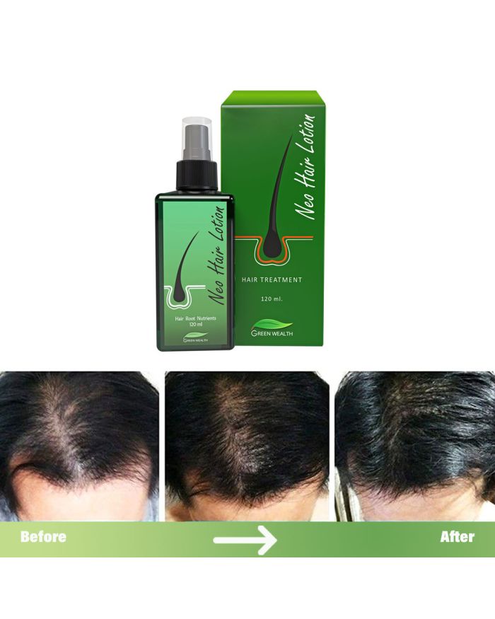 Aceite Serum Crecimiento Del Cabello